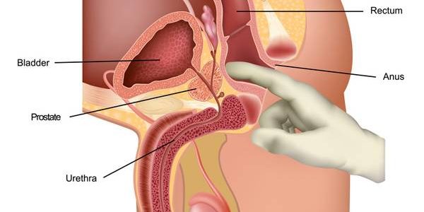 How To Check Your Own Prostate