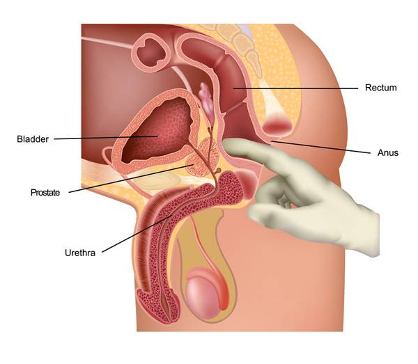 Examine The Prostate