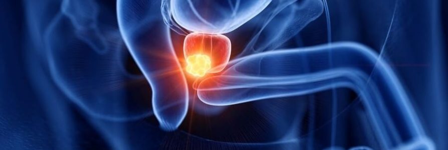 Everything You Need to Know About Prostate