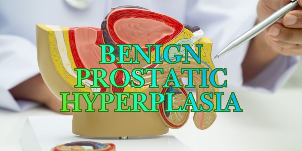 What Is Benign Prostatic Hyperplasia? Find Out Now