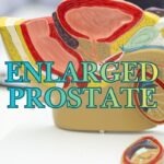 Prostate Enlargement Causes