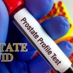 prostate fluid function